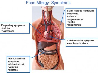 figuur-3-symptoms-640